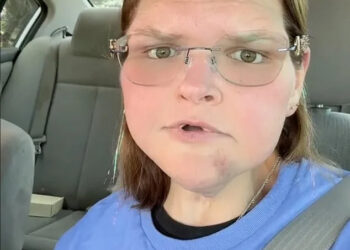 Tammy Slaton Bruise, TikTok