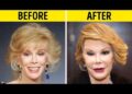 50+ Celebrity Plastic Surgery Disasters | Before and After