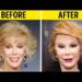 50+ Celebrity Plastic Surgery Disasters | Before and After