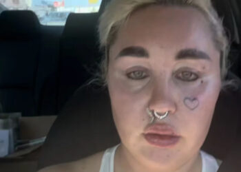 Amanda Bynes Shares New Look After Getting Lip Injections