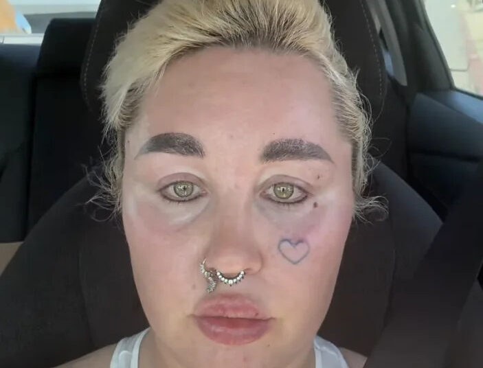 Amanda Bynes showed off fuller lips on Friday after revealing she had lip filler injections.