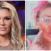 Brandi Glanville Used Nair On Her Face For A Skin Condition