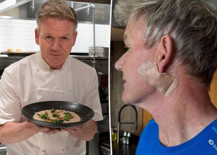 Gordon Ramsay reveals skin cancer diagnosis
