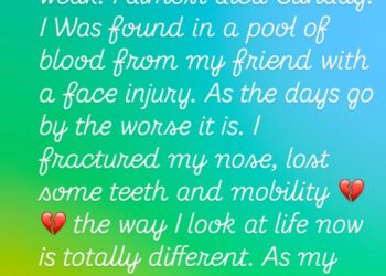 Tamar Braxton Says She Almost Died After Suffering Face Injury and Losing Teeth Pray for Me