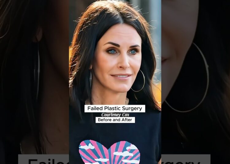 Celebrities Who’ve Had Plastic Surgery Failures-Before and After #plasticsurgery #usa