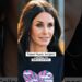 Celebrities Who’ve Had Plastic Surgery Failures-Before and After #plasticsurgery #usa