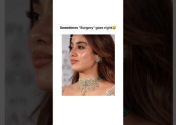 When surgery goes well✅😅#shorts #janhvikapoor #plasticsurgery #celebrity #bollywood #skincare