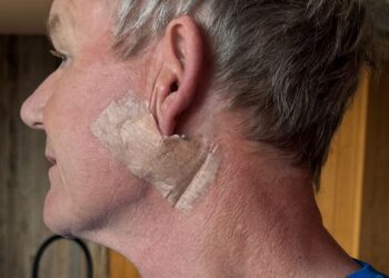 Gordon Ramsay Reveals Skin Cancer Diagnosis, Surgery: ‘Please Don’t Forget Your Sunscreen’ – Globe Magazine