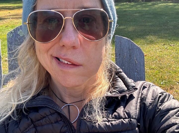Lauren Weedman shared photos after experiencing symptoms of Bell's palsy.