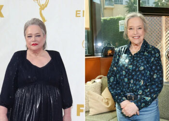 Kathy Bates before and after weight loss