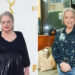 Kathy Bates before and after weight loss