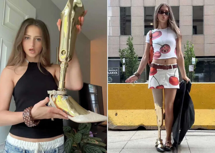 Model 'Elevates' Outfits with Her Chrome Prosthetic Leg. Her Style and Humor Have Won Over TikTok (Exclusive)
