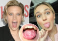What is 'geographic tongue'? All about 'SNL' star Kate McKinnon's 'gross' condition