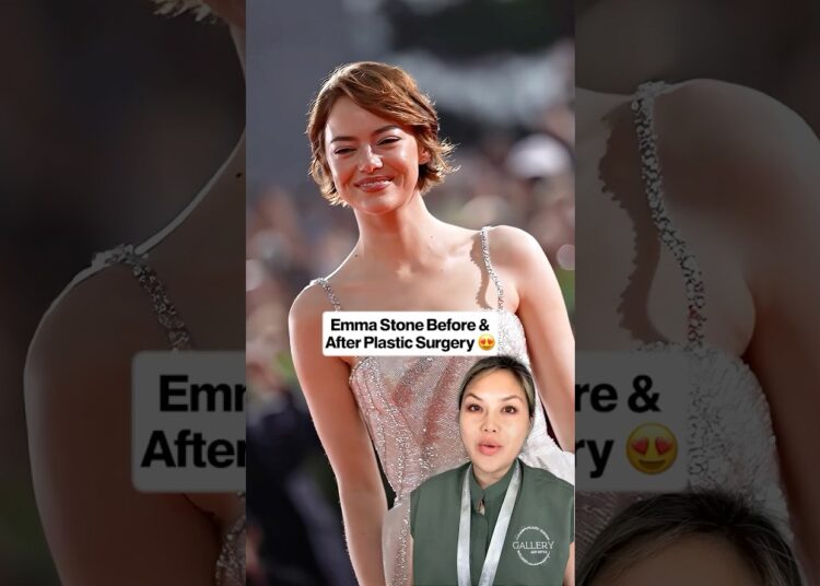 Emma Stone before and after plastic surgery #emmastone #plasticsurgeon #celebrity