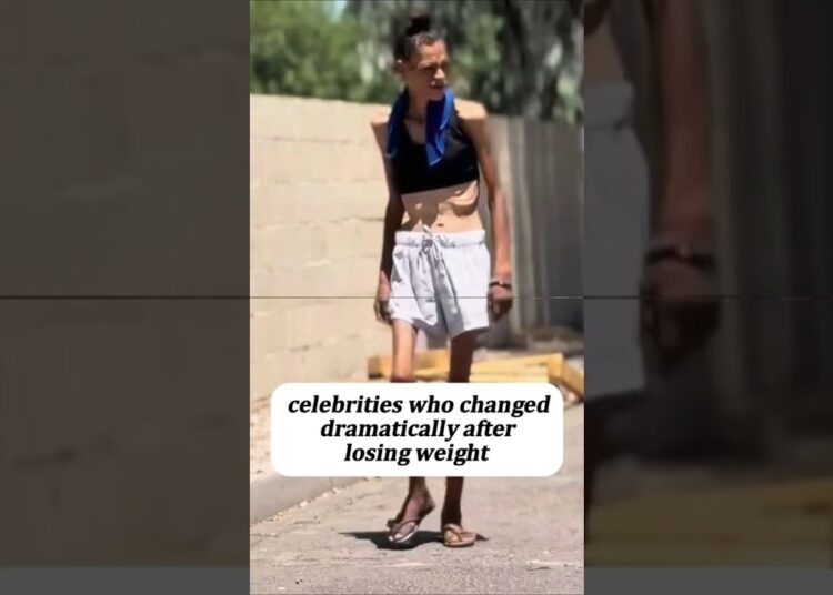 celebs who changed dramatically after losing weight #celebrity #celebritynews #viral #shorts