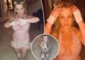 Britney Spears suffers gruesome knee injury after falling down stairs