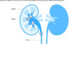1010 Kidney stones
