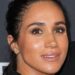 Inside Meghan Markle's glow up with 'advanced skincare treatments' - Celebrity News - Entertainment