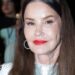 Janice Dickinson sues ITV over I'm a Celebrity injury