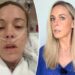 Kate Gosselin reveals 'life-altering' injury that landed her in the hospital