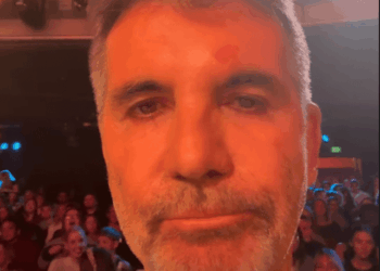 Simon Cowell Suffers Head Injury
