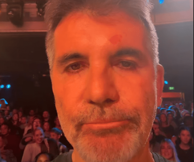 Simon Cowell Suffers Head Injury