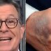 Stephen Colbert Has A Theory About That Bruise On Trump's Hand