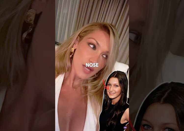 Celebrities Who Regret Their Cosmetic Procedures