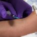 A closer look at the unapproved peptide injections promoted by influencers and celebrities