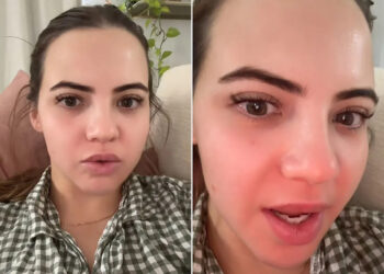 Bobbi Althoff Says Her Face Is 'Paralyzed' After Receiving 100 Units of ‘Botched’ Botox