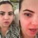 Bobbi Althoff Says Her Face Is 'Paralyzed' After Receiving 100 Units of ‘Botched’ Botox