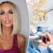 Inside Jenny McCarthy's infections from a failed dental implant