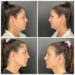 Jennifer Belen Jennifer Belen before her plastic surgery (top) and after (bottom)