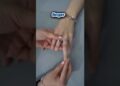 Art of Rebuilding a Missing Finger” 😲😍#shorts #ytshorts #shortsfeed #artist #art #lifehacks #gadgets