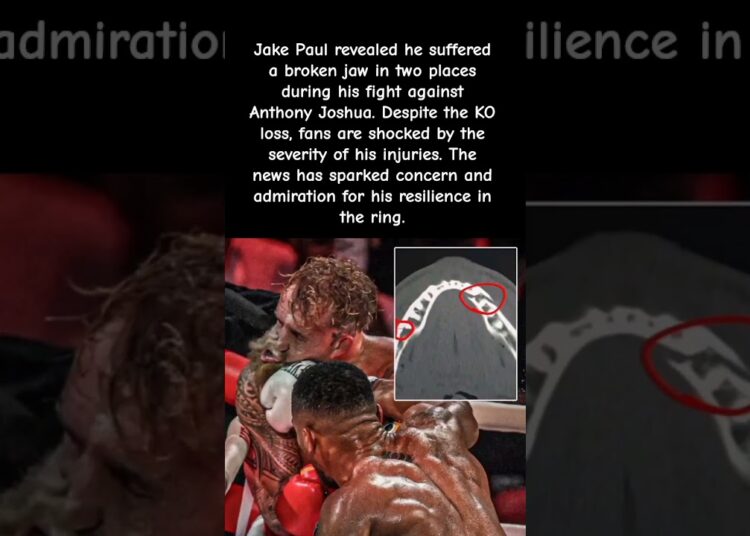 Jake Paul Breaks Jaw in Two Places Against Anthony Joshua 😳 #celebrity