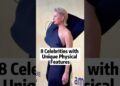 8 Celebrities with Unique Physical Features #celebrity #foryoupage #fyp