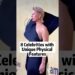 8 Celebrities with Unique Physical Features #celebrity #foryoupage #fyp