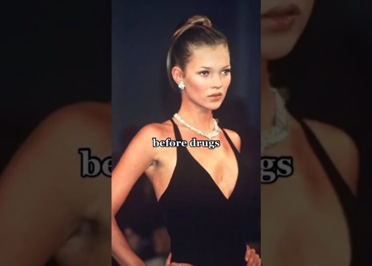 Before Drugs & After #Katemoss #model #catwalk #shortfeed #supermodel #celebrities