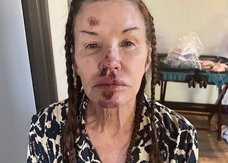 Janice Dickenson Shares Photos From Brutal On Set Injury