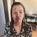 Janice Dickenson Shares Photos From Brutal On Set Injury