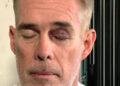 Joe Buck/X Joe Buck shows off his black eye in a selfie