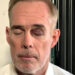Joe Buck/X Joe Buck shows off his black eye in a selfie