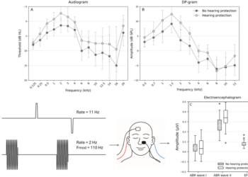 Large-scale music events can cause subclinical hearing damage