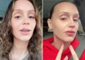 Mormon Wives Mikayla Matthews Dissolves the Rest of Her Lip Filler
