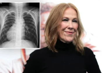 What is dextrocardia? Catherine O'Hara's rare heart condition