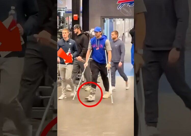 Josh Allen’s leg injury and his use of crutches#shorts #celebrity #nfl #joshallen