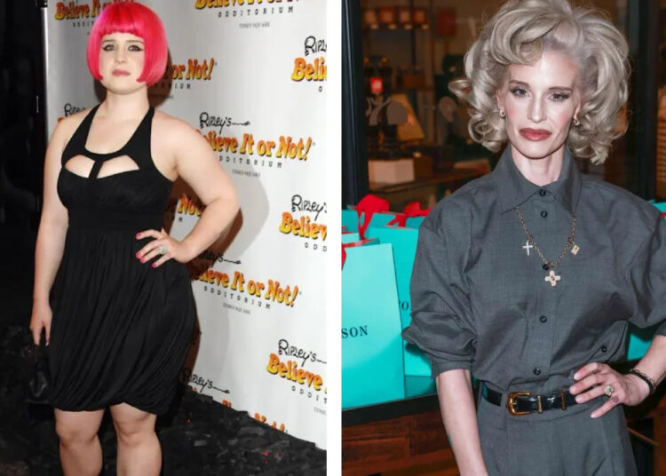 celebrity-transformations-drastic-changes