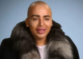 Jordan James Parke on 'Botched'Credit: E!