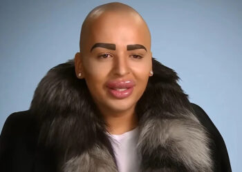 Jordan James Parke on 'Botched'Credit: E!