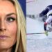 Lindsey Vonn Shows Off Her X-Ray ... And Yikes